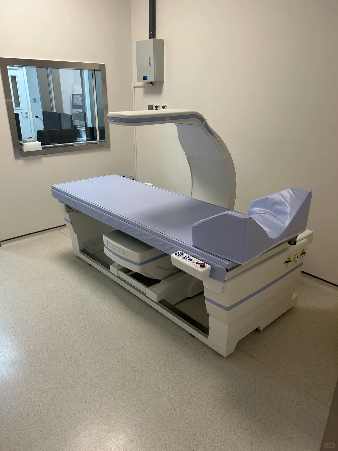 Dual-energy X-ray bone density scanning equipment